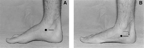 tibialis posterior exercises and navicular drop test|navicular drop and talus.